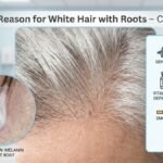 Reason for White Hair