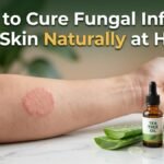 How to cure fungal infection on skin naturally at home